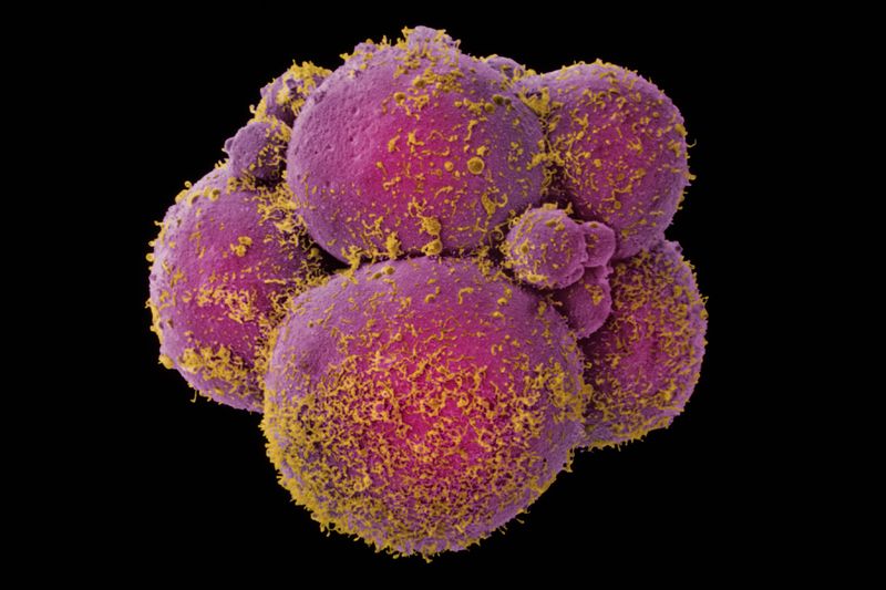 A human embryo at the eight-cell stage. Photo: Yorgos Nikas / SPL
