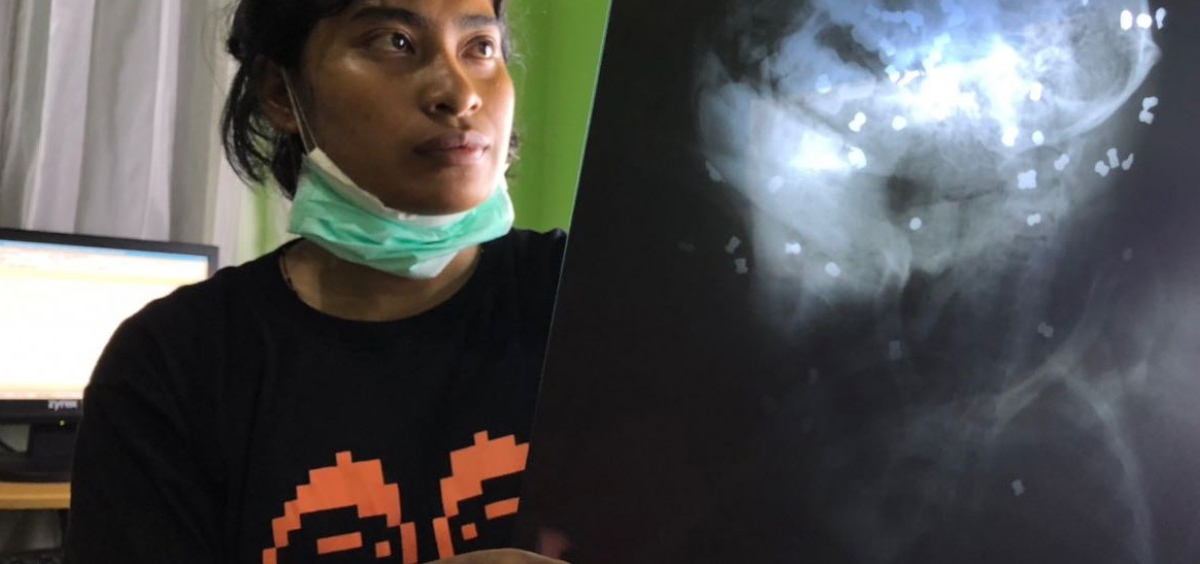 A veterinarian looks at an X-ray photo of the Bornean orangutan, showing 130 pellets in its body. The male Bornean orangutan (Pongo pygmaeus) was found barely alive on 5 February 2018 by officials from Kutai National Park in East Kalimantan. It died the next day from its extensive injuries. Photo: Centre for Orangutan Protection