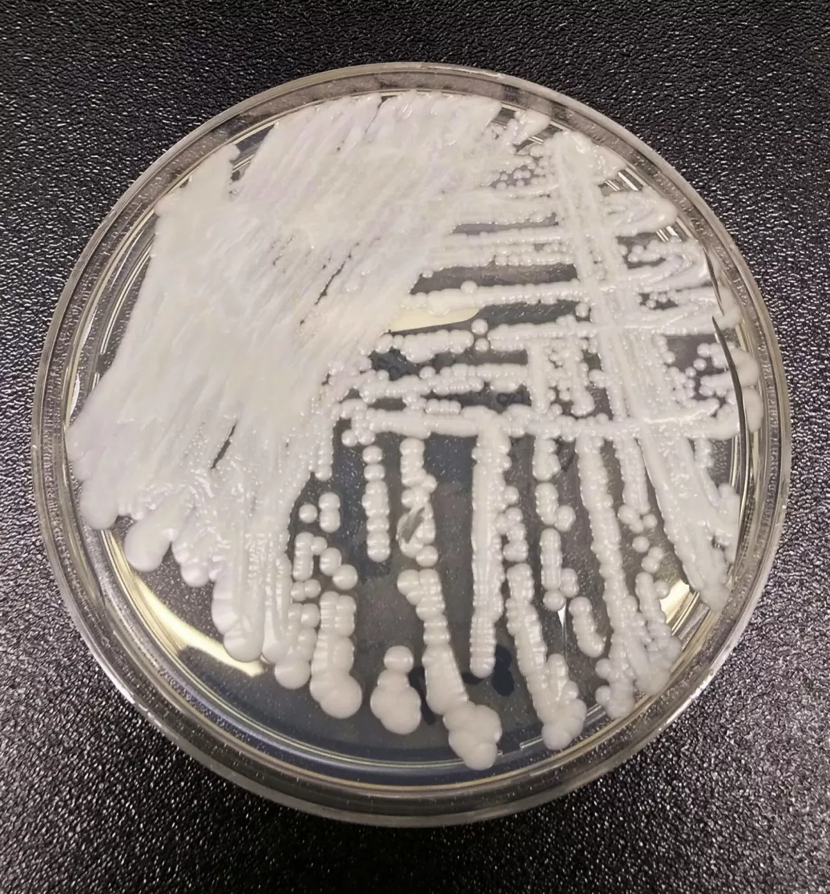 A strain of Candida auris cultured in a Centers for Disease Control and Prevention laboratory. The CDC reports that the fungus is causing infections in healthcare facilities.Photo: Shawn Lockhart / Associated Press
