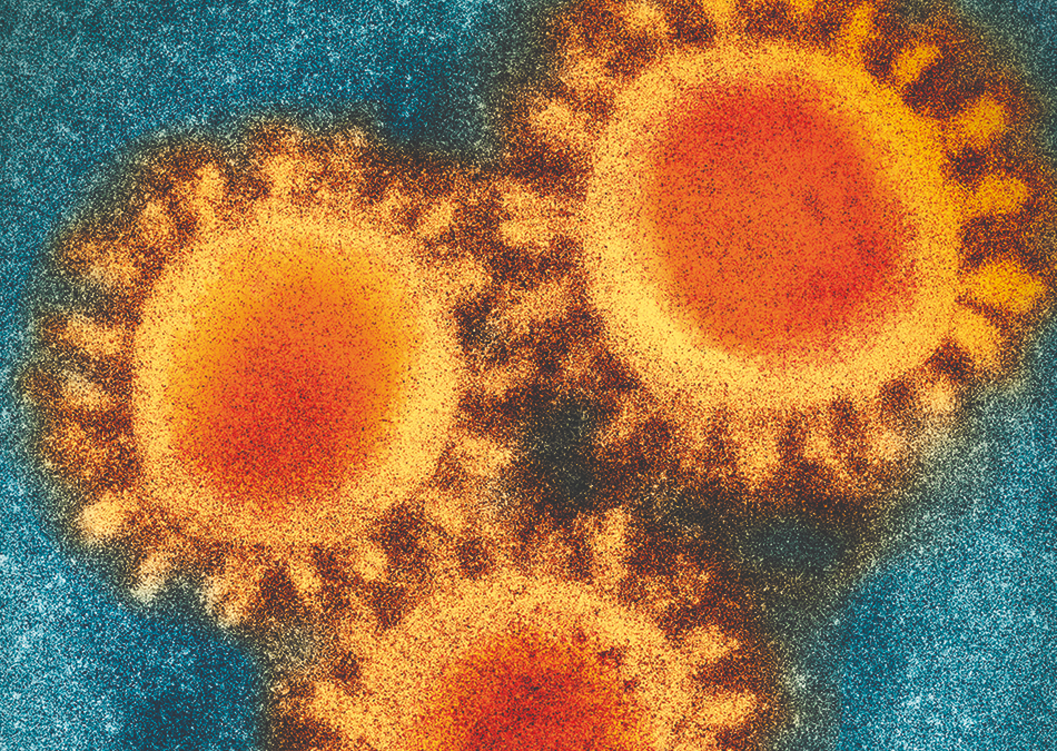 Colored visualization of electron microscopy photo of the SARS-CoV-2 virus. Graphic: narvikk / iStock.com