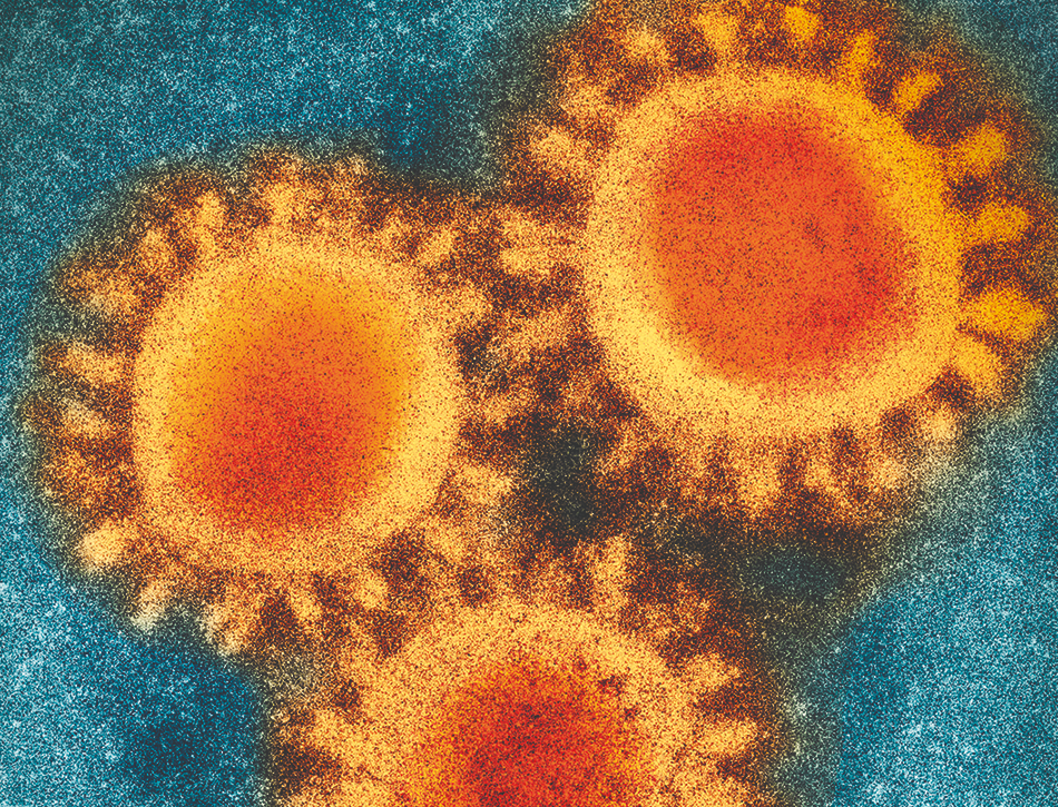 Colored visualization of electron microscopy photo of the SARS-CoV-2 virus. Graphic: narvikk / iStock.com